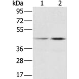 RBMX Antibody from Signalway Antibody (36522) - Antibodies.com