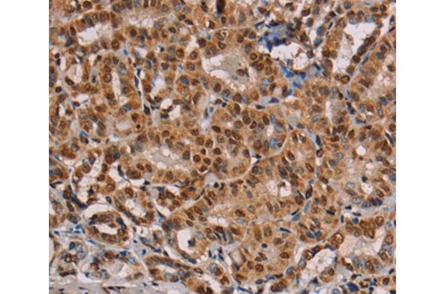 Immunohistochemistry - RBMX Antibody from Signalway Antibody (36522) - Antibodies.com