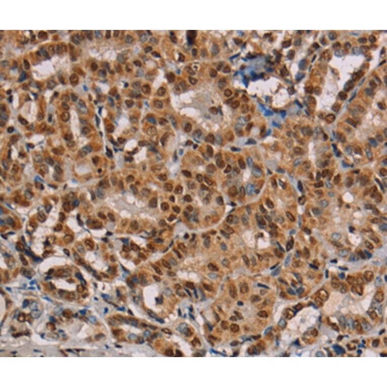 Immunohistochemistry - RBMX Antibody from Signalway Antibody (36522) - Antibodies.com