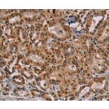 Immunohistochemistry - RBMX Antibody from Signalway Antibody (36522) - Antibodies.com