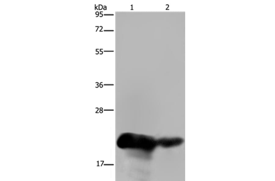 CSH1 Antibody from Signalway Antibody (36527) - Antibodies.com
