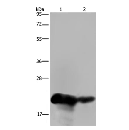 CSH1 Antibody from Signalway Antibody (36527) - Antibodies.com
