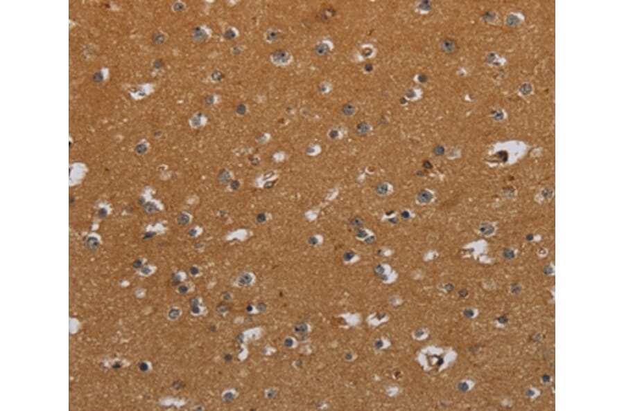 Immunohistochemistry - CSH1 Antibody from Signalway Antibody (36527) - Antibodies.com