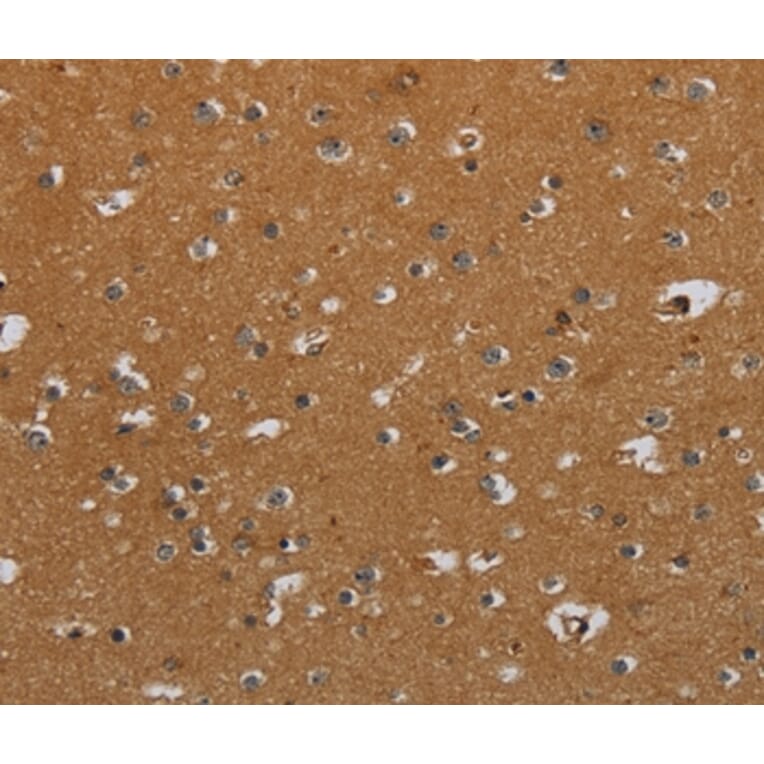 Immunohistochemistry - CSH1 Antibody from Signalway Antibody (36527) - Antibodies.com