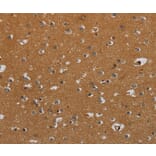 Immunohistochemistry - CSH1 Antibody from Signalway Antibody (36527) - Antibodies.com