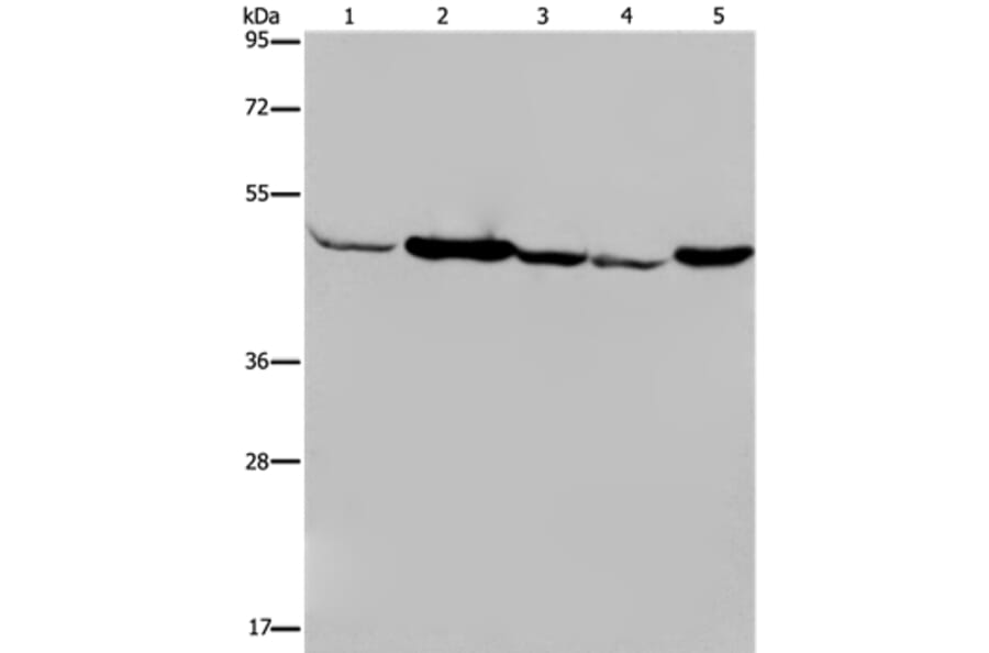 IDH2 Antibody from Signalway Antibody (36544) - Antibodies.com