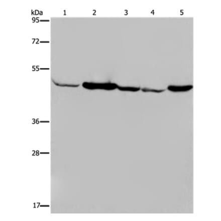 IDH2 Antibody from Signalway Antibody (36544) - Antibodies.com