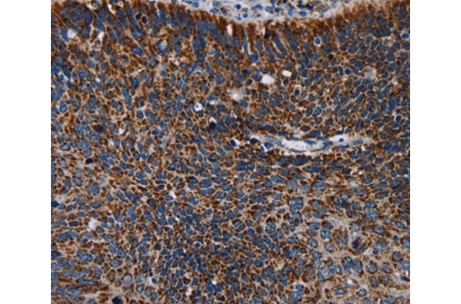 Immunohistochemistry - IDH2 Antibody from Signalway Antibody (36544) - Antibodies.com