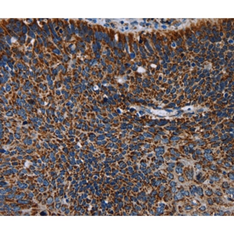 Immunohistochemistry - IDH2 Antibody from Signalway Antibody (36544) - Antibodies.com