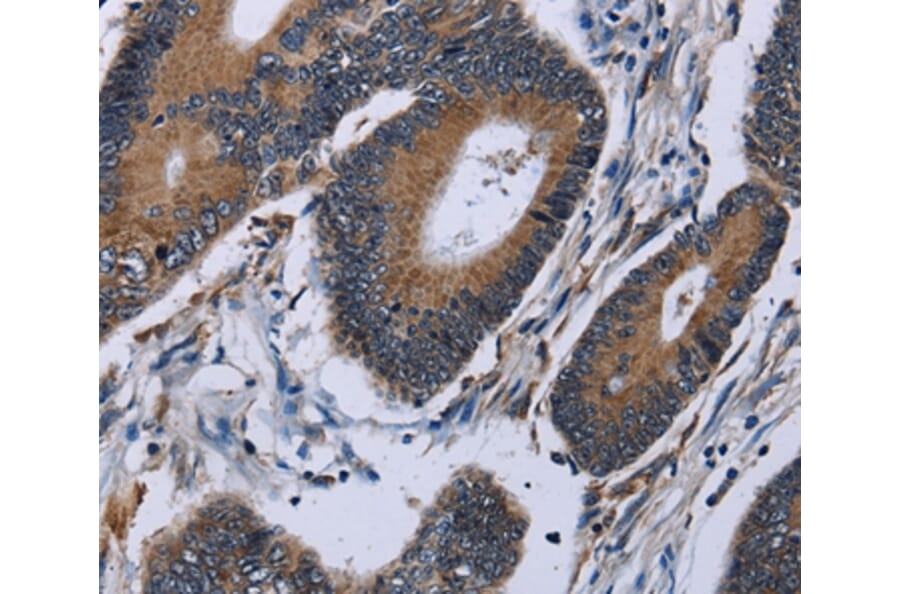 Immunohistochemistry - IPO4 Antibody from Signalway Antibody (36555) - Antibodies.com