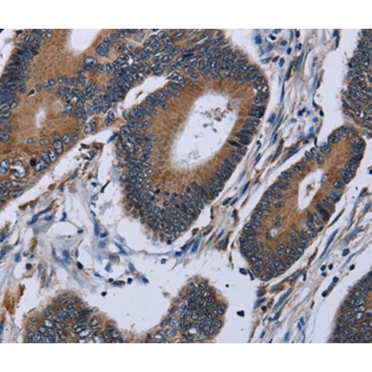 Immunohistochemistry - IPO4 Antibody from Signalway Antibody (36555) - Antibodies.com
