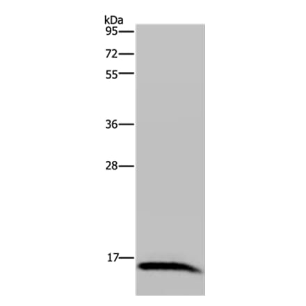 IRGM Antibody from Signalway Antibody (36558) - Antibodies.com