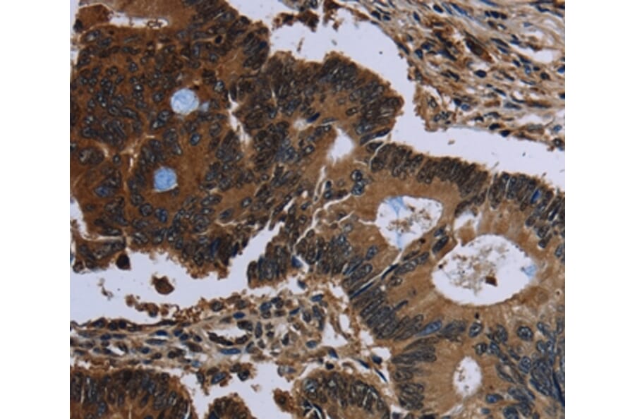 Immunohistochemistry - IRGM Antibody from Signalway Antibody (36558) - Antibodies.com