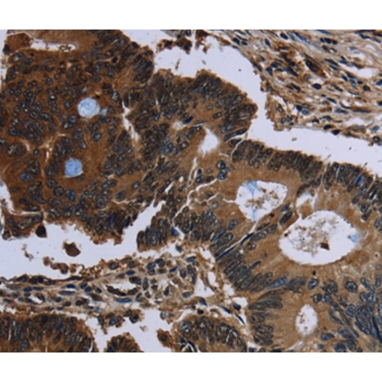 Immunohistochemistry - IRGM Antibody from Signalway Antibody (36558) - Antibodies.com