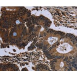 Immunohistochemistry - IRGM Antibody from Signalway Antibody (36558) - Antibodies.com