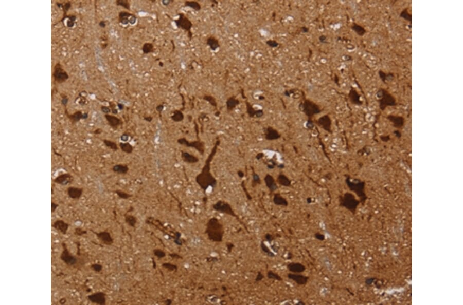 Immunohistochemistry - KARS Antibody from Signalway Antibody (36565) - Antibodies.com