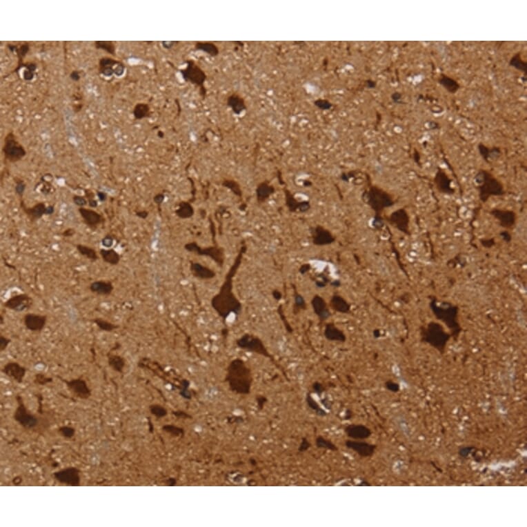 Immunohistochemistry - KARS Antibody from Signalway Antibody (36565) - Antibodies.com