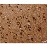 Immunohistochemistry - KARS Antibody from Signalway Antibody (36565) - Antibodies.com