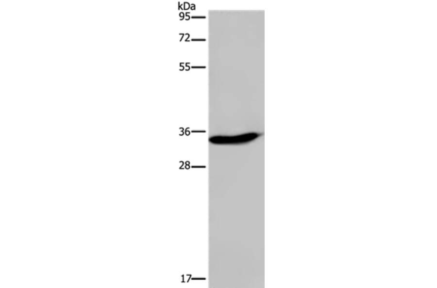 KLK6 Antibody from Signalway Antibody (36575) - Antibodies.com