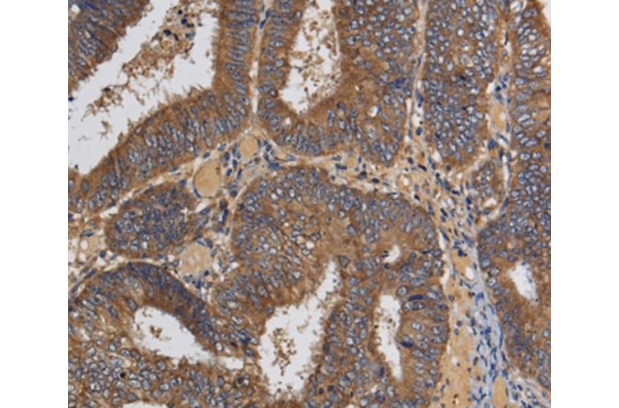 Immunohistochemistry - KLK6 Antibody from Signalway Antibody (36575) - Antibodies.com