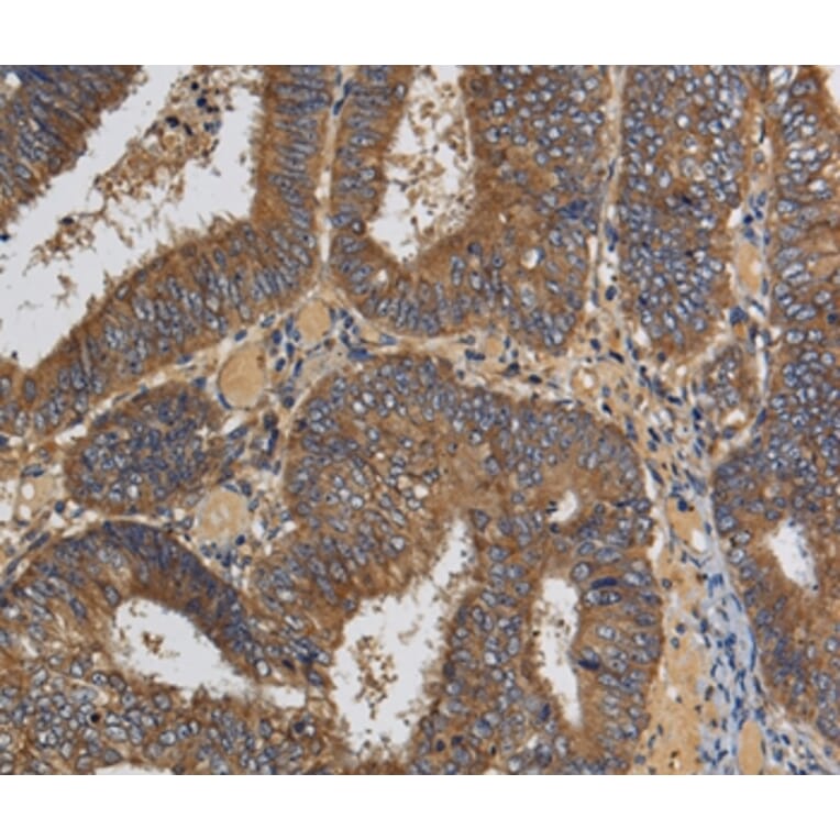 Immunohistochemistry - KLK6 Antibody from Signalway Antibody (36575) - Antibodies.com