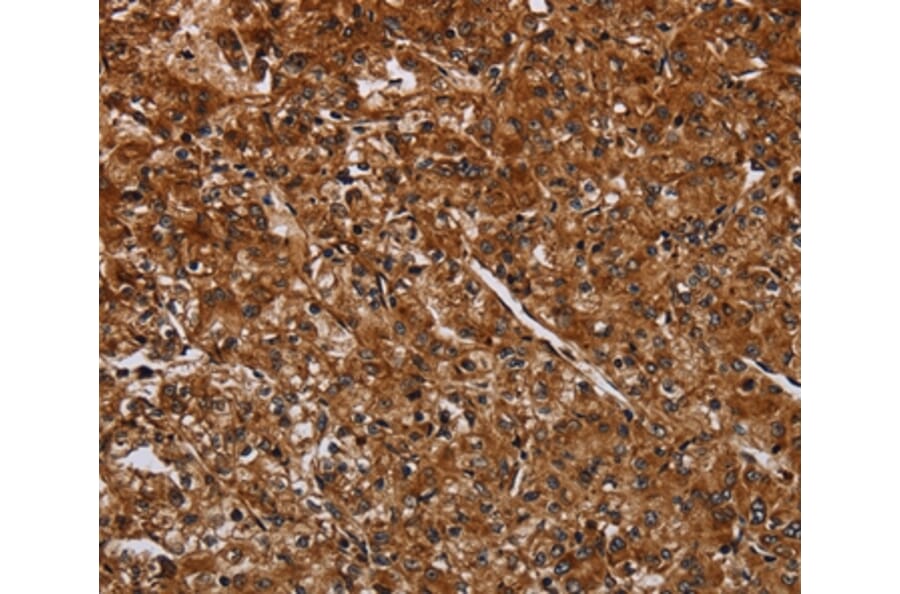 Immunohistochemistry - ACP6 Antibody from Signalway Antibody (36587) - Antibodies.com