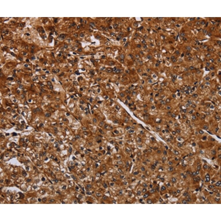 Immunohistochemistry - ACP6 Antibody from Signalway Antibody (36587) - Antibodies.com