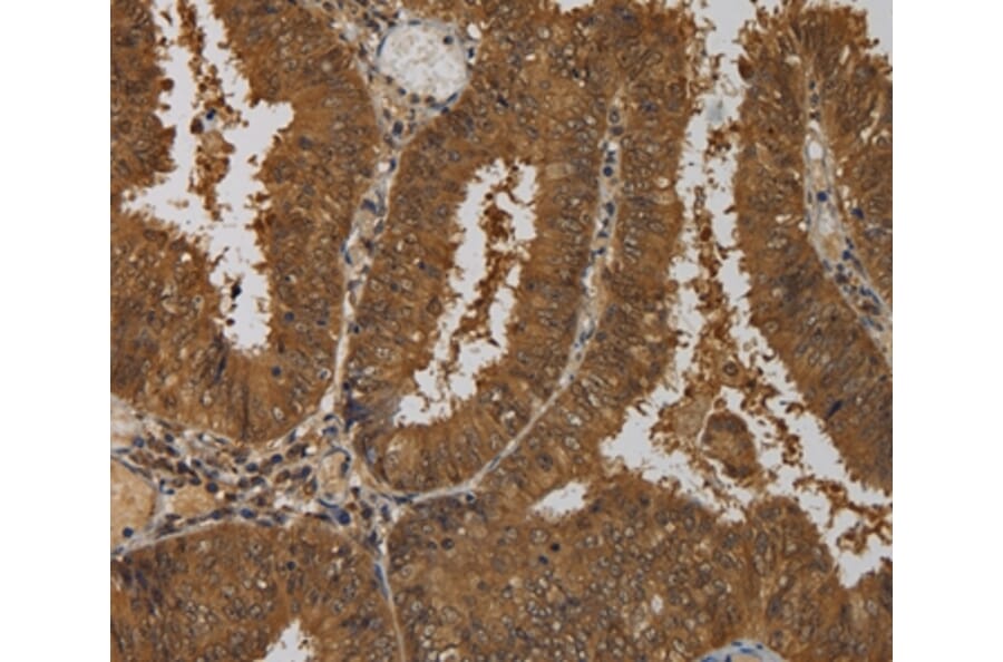Immunohistochemistry - TAB1 Antibody from Signalway Antibody (36598) - Antibodies.com