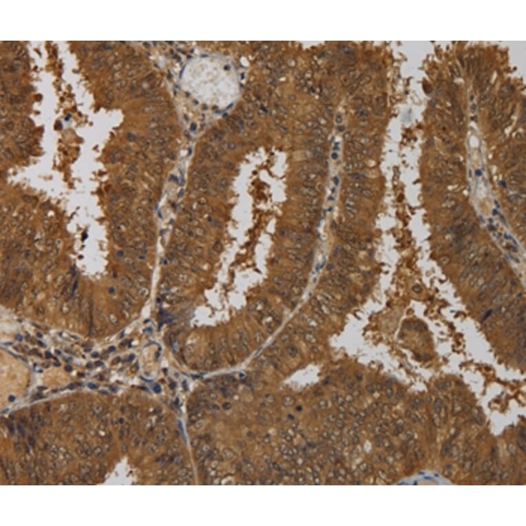 Immunohistochemistry - TAB1 Antibody from Signalway Antibody (36598) - Antibodies.com