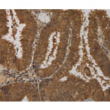 Immunohistochemistry - TAB1 Antibody from Signalway Antibody (36598) - Antibodies.com