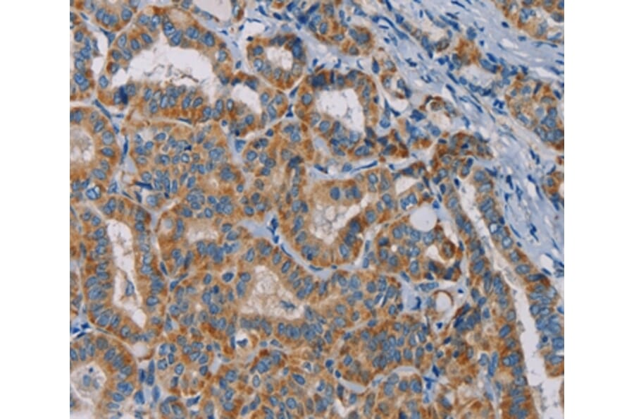 Immunohistochemistry - TAB3 Antibody from Signalway Antibody (36599) - Antibodies.com