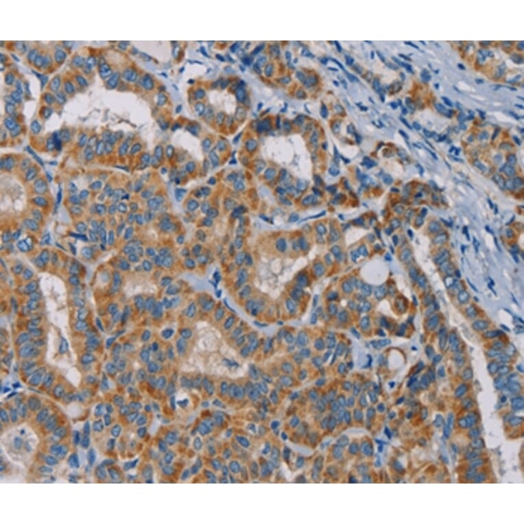 Immunohistochemistry - TAB3 Antibody from Signalway Antibody (36599) - Antibodies.com