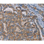 Immunohistochemistry - TAB3 Antibody from Signalway Antibody (36599) - Antibodies.com