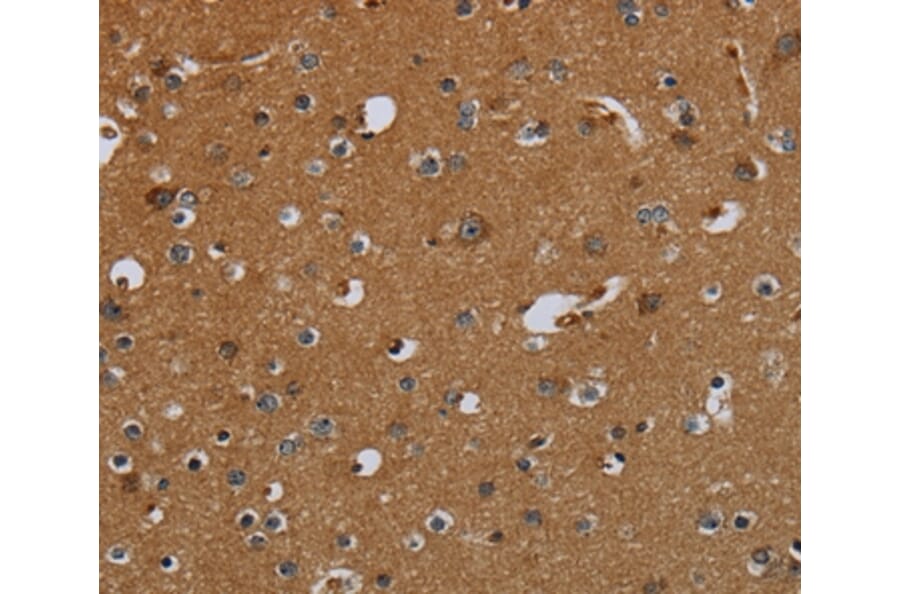 Immunohistochemistry - PCK2 Antibody from Signalway Antibody (36616) - Antibodies.com