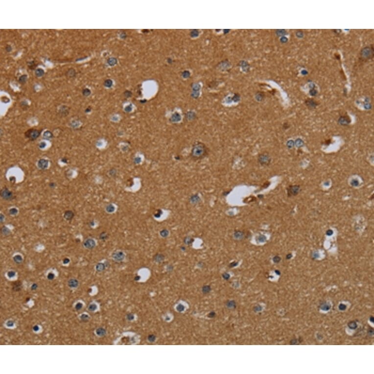 Immunohistochemistry - PCK2 Antibody from Signalway Antibody (36616) - Antibodies.com