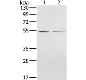 NMT2 Antibody from Signalway Antibody (36654) - Antibodies.com