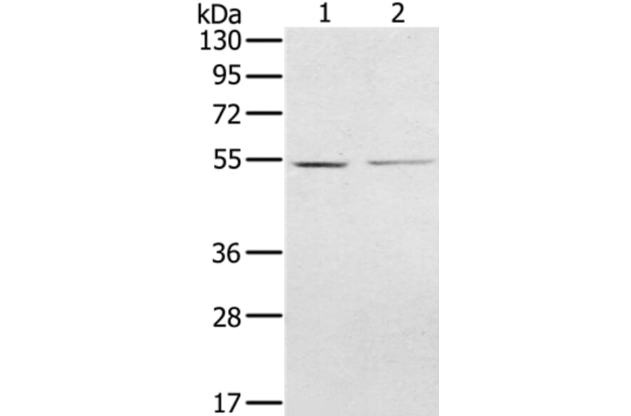 NMT2 Antibody from Signalway Antibody (36654) - Antibodies.com