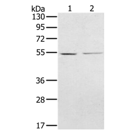 NMT2 Antibody from Signalway Antibody (36654) - Antibodies.com