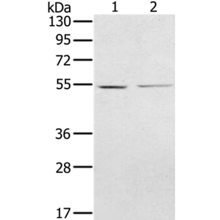 NMT2 Antibody from Signalway Antibody (36654) - Antibodies.com