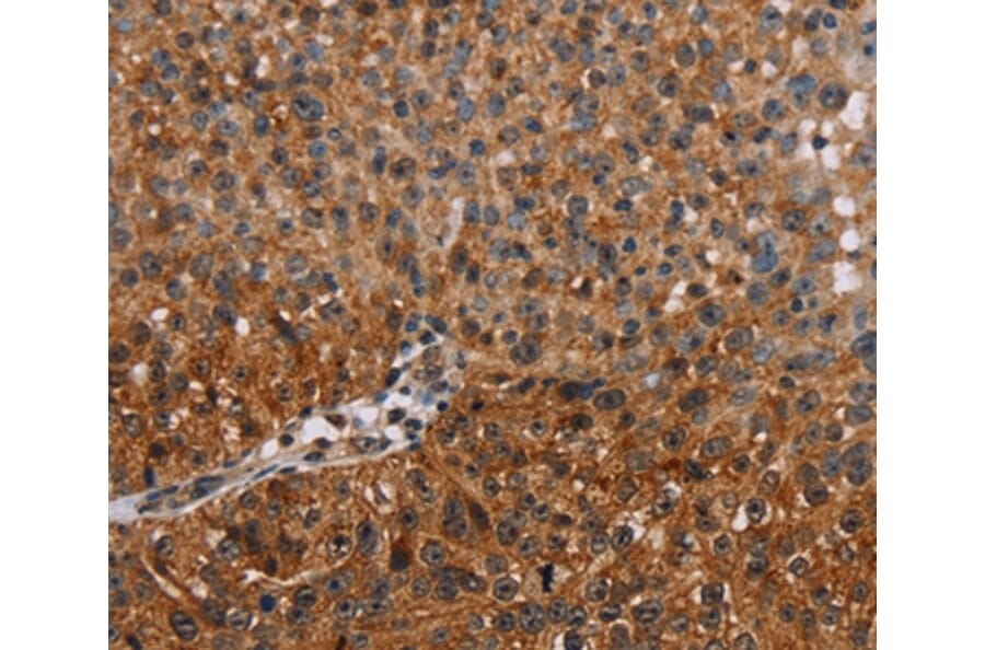 Immunohistochemistry - NMT2 Antibody from Signalway Antibody (36654) - Antibodies.com
