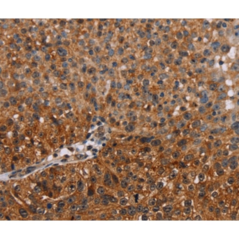 Immunohistochemistry - NMT2 Antibody from Signalway Antibody (36654) - Antibodies.com