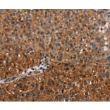 Immunohistochemistry - NMT2 Antibody from Signalway Antibody (36654) - Antibodies.com