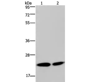 NPM3 Antibody from Signalway Antibody (36658) - Antibodies.com