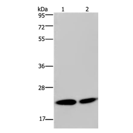 NPM3 Antibody from Signalway Antibody (36658) - Antibodies.com