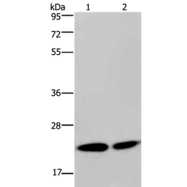 NPM3 Antibody from Signalway Antibody (36658) - Antibodies.com