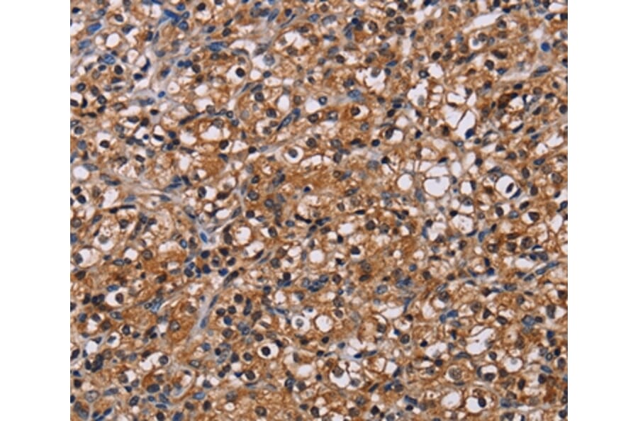 Immunohistochemistry - NPM3 Antibody from Signalway Antibody (36658) - Antibodies.com