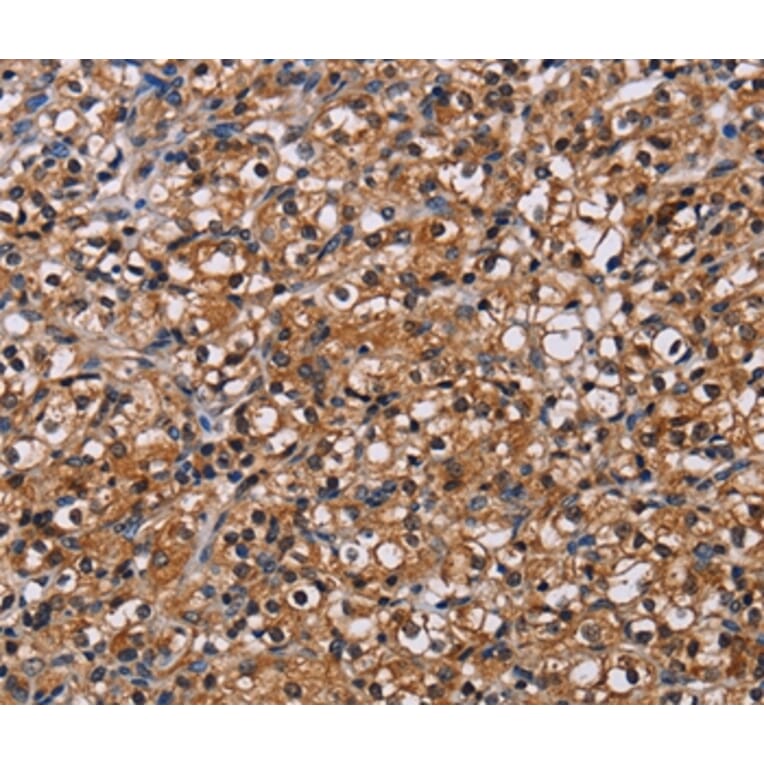 Immunohistochemistry - NPM3 Antibody from Signalway Antibody (36658) - Antibodies.com