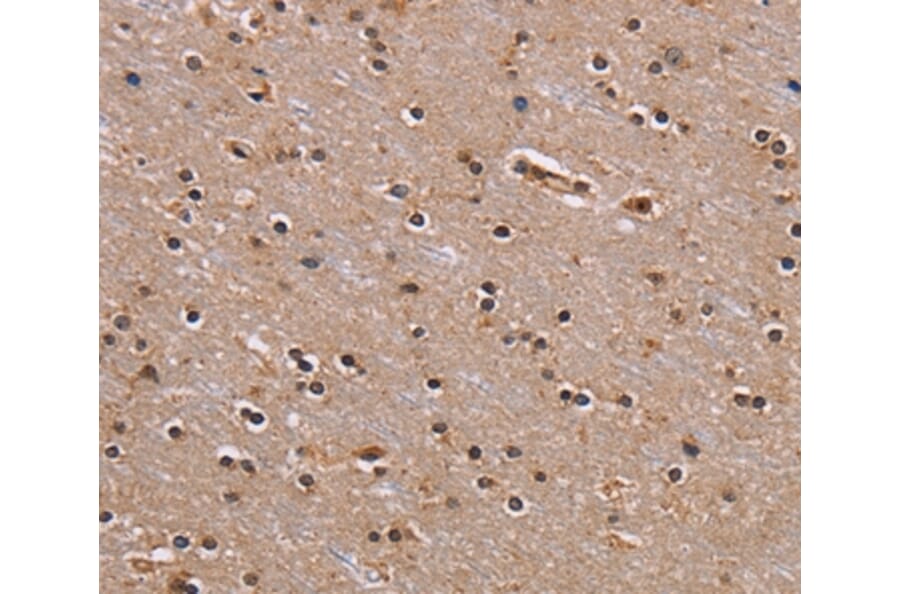 Immunohistochemistry - GNL3 Antibody from Signalway Antibody (36662) - Antibodies.com