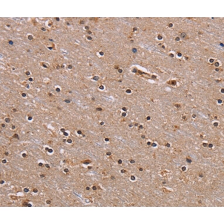 Immunohistochemistry - GNL3 Antibody from Signalway Antibody (36662) - Antibodies.com