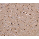 Immunohistochemistry - GNL3 Antibody from Signalway Antibody (36662) - Antibodies.com